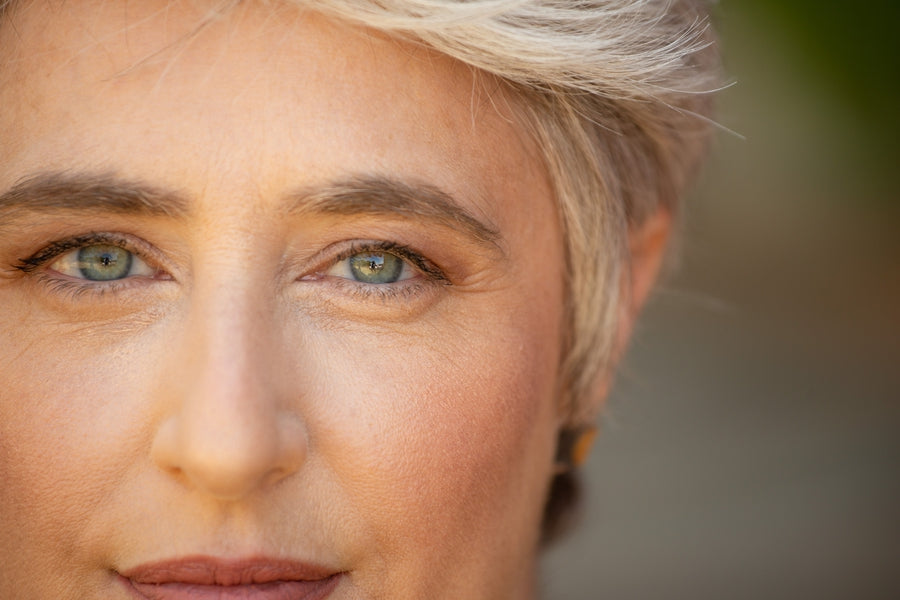 ¿Sabes qué tipo de ojeras tienes?