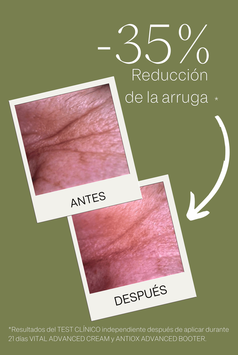 VITAL ADVANCED CREAM